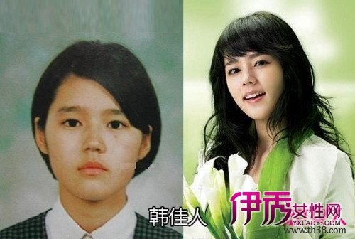 韩国女星韩佳人<em>整容前后</em>对比<em>照片</em>_最新整容_