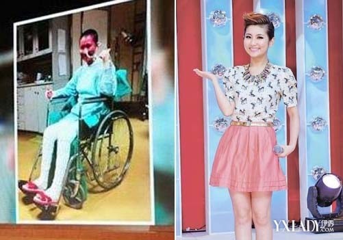 [组图]开讲啦 selina烧伤 事件疤痕图片公开 推荐