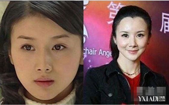 【图】郑爽整容后张翰惊呆 刘诗诗霍思燕姚笛等女星整容前后对比(5)_五官整形_美容-伊秀女性网|yxlady.com