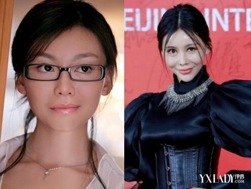 王心凌整容脸僵硬下巴变尖 娱乐圈女星整容前后对比谁最成功