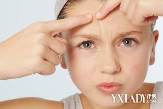 【图】 额头老长痘痘怎么办?如何进行日常护理