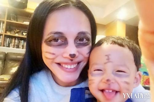 【图】黑眼圈严重是什么原因呢 科学解释黑眼