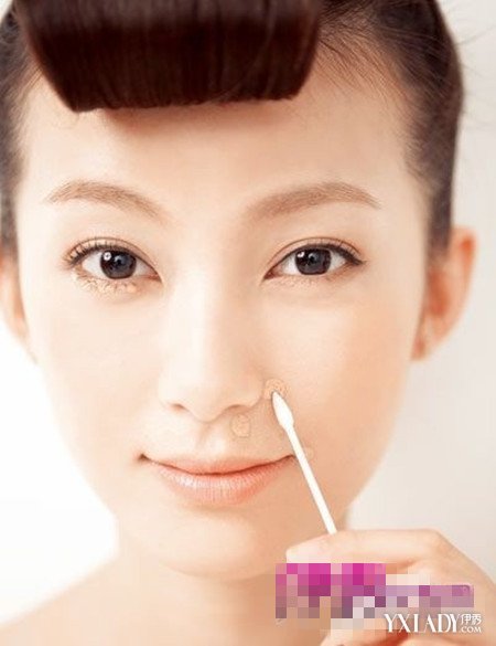 【图】脸上痘痘变成暗红色怎么办呢 注意饮食