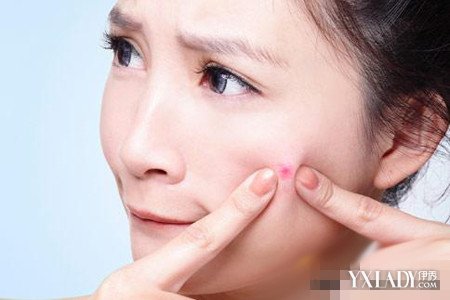 【图】为什么我的痘痘是痒的 小妙招助你祛痘