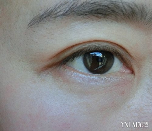 【图】下眼皮有眼袋怎么办呢 五大办法改善眼