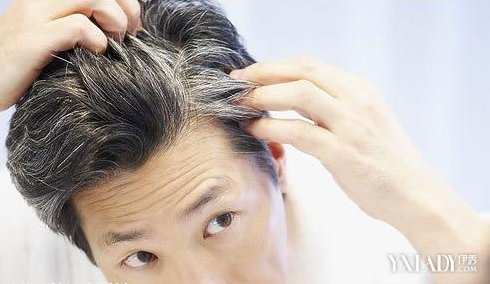 【图】白色<em>头发</em>怎么<em>变黑</em> 介绍4个<em>妙方</em>让你更年