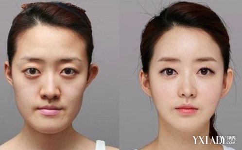 【图】整脸型整容多少钱 影响整脸型价格的4大