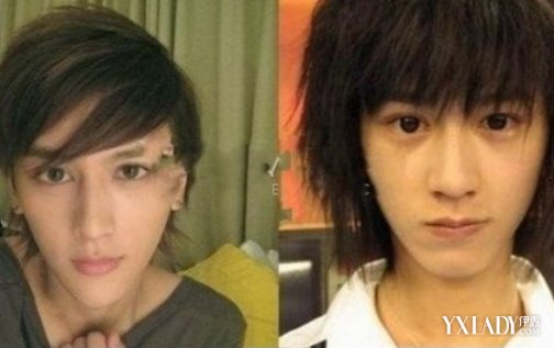 【图】整脸型整容多少钱 影响整脸型价格的4大