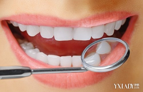 【图】洗牙后注意事项 洗牙对牙齿有伤害吗?(