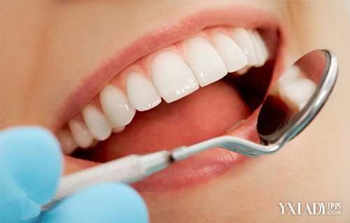 【图】洗牙后注意事项 洗牙对牙齿有伤害吗?_