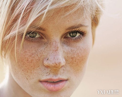 【图】色斑和雀斑的区别图片分享 轻松了解它