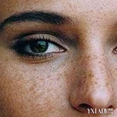 【图】黄斑水肿怎么办? 了解得黄斑的病因(3)_