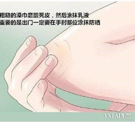 【图】手肘黑怎么变白 轻松搞定手肘黑问题-美容护肤-襄阳城市网