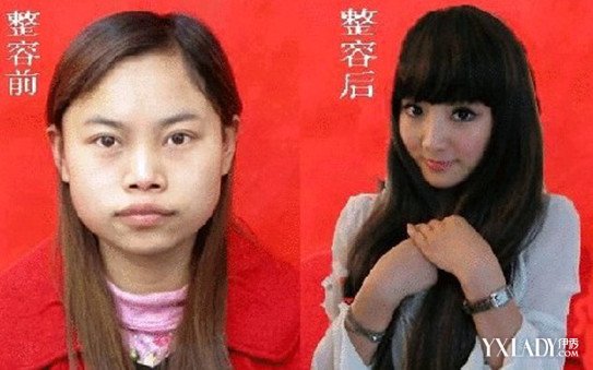 【图】凤姐整容后照片对比 整形不是丑女人的专利