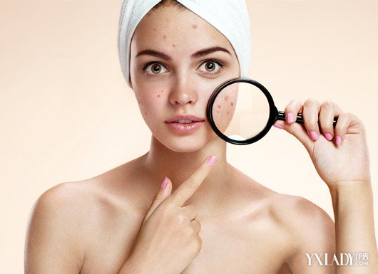 【图】揭痘痘长在不同部位的原因 让痘痘告诉