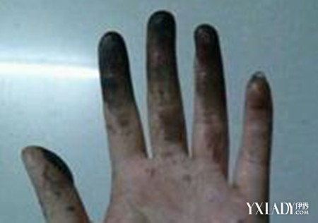 【图】染发剂弄手上怎么洗? 家常小知识告诉你