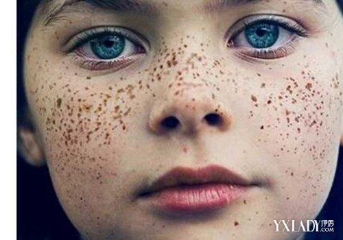 【图】怎样去除黑色素沉积比较有效 5个有效去除黑色素的方法(3)_怎样去除黑色素沉积_伊秀美容网|yxlady.com