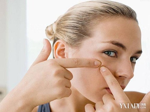 【图】怎样有效消除青春痘呢? 三大祛痘绝招让