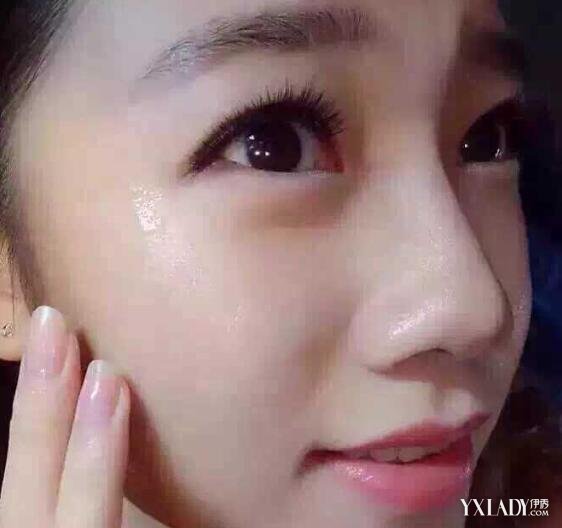 【图】微针多久做一次好呢? 专家带你了解做微