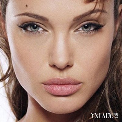 【图】脑门上长痘痘怎么治啊 几个小妙招帮你