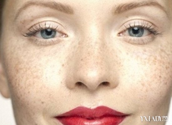 【图】激光治疗祛雀斑的危害有哪些 介绍六大