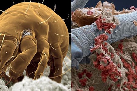 【图】螨虫过敏怎样避免 这样做让肌肤更舒适