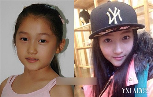 【组图】 揭娱圈女童星惊人蜕变  关晓彤瘦脸方