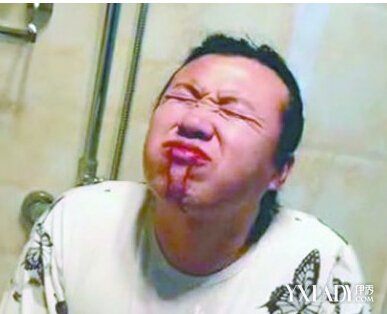 【图】大连蓝天霸狂饮20斤视频火爆 喝酒后胃