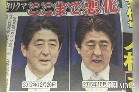 【图】安倍大肠癌晚期脸变黑皱纹横生 大肠癌