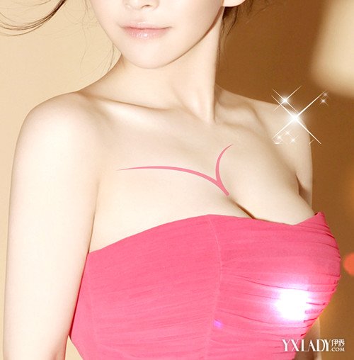 【图】乳房下垂照片展示 教你如何预防乳房下