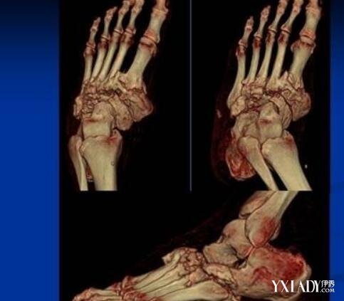 【图】人体脚掌骨骼图展示 专业图像让你轻松了解知识