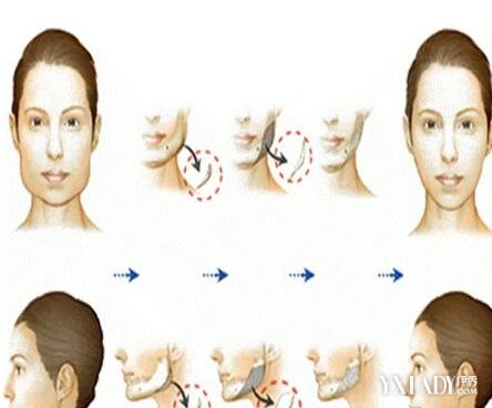 【图】怎么样可以瘦咬肌 六个快速瘦咬肌的方