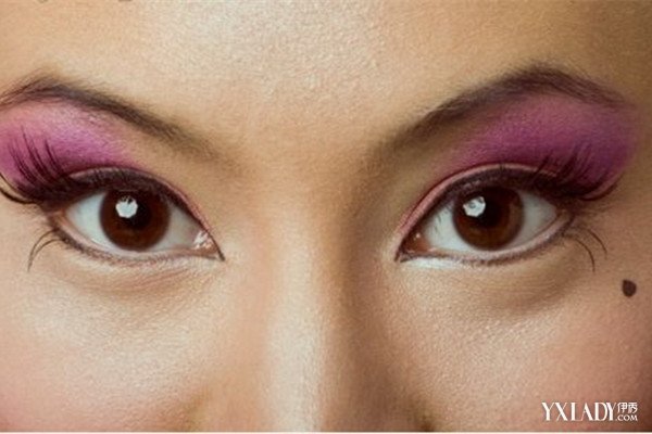 【图】什么能去痣呢? 分享3种祛痣方法要掌握