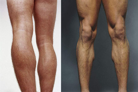 【图】男生标准腿型图片 这样做你也可以拥有大长腿