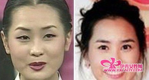  李多海整容前后 照曝光 李多海主演的电视剧盘