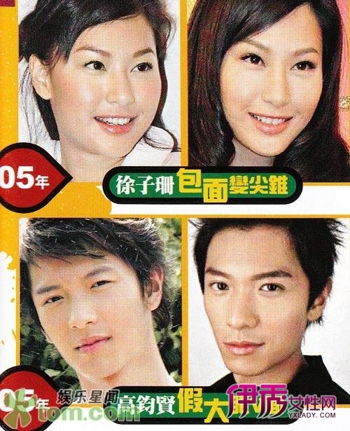 港媒曝郑嘉颖<em>黄奕</em>林峰<em>整容</em>前后<em>照片</em>(7)_港台星