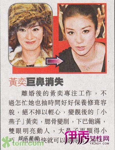 港媒曝郑嘉颖<em>黄奕</em>林峰<em>整容</em>前后<em>照片</em>(11)_港台