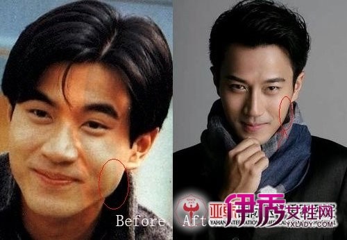  刘恺威整容前后 对比照 面部疑多处整容(4)_港台