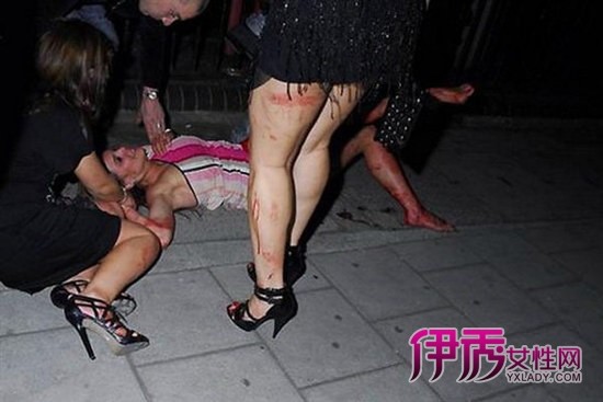 孙菲菲被打+盘点娱乐圈遭毒打