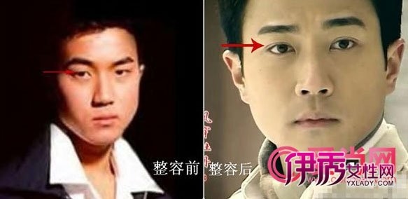  刘恺威 爸爸刘丹照片曝光  刘恺威 整容有图有真