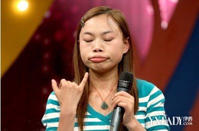 【图】<em>凤姐整容后</em>的<em>照片</em> 丑女变美女也有广告