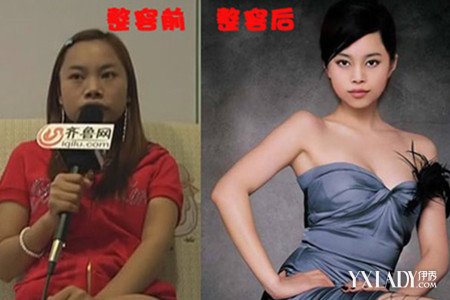 【图】<em>凤姐整容后</em>最新<em>照片</em>惊呆网友 融资千万