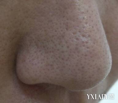 ���Ӻ�ͷ��ô��