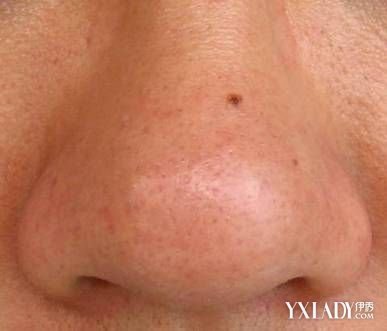 ���Ӻ�ͷ��ô��