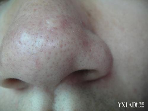 ���Ӻ�ͷ��ô��