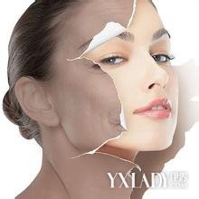 �����۷�ȥ��