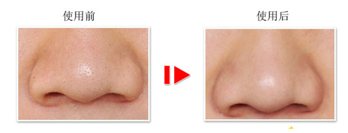 ȥ��ͷ��ë��