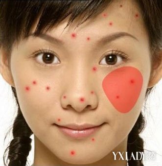 �°ͳ�������ô��