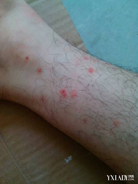 Ƥ����������