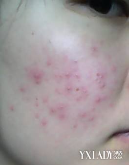 �����к�Ѫ˿